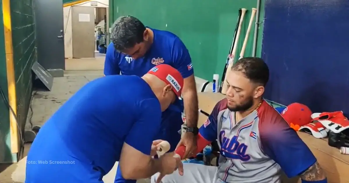 Yoan Moncada luego del pelotazo