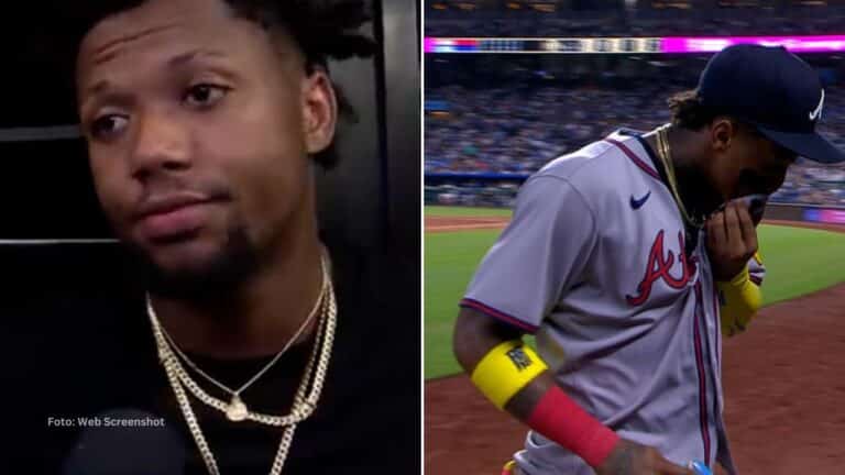 El pelotero venezolano Ronald Acuña Jr. podría regresar al terreno en menos de un mes si la resonancia confirma que no hay lesión significativa.