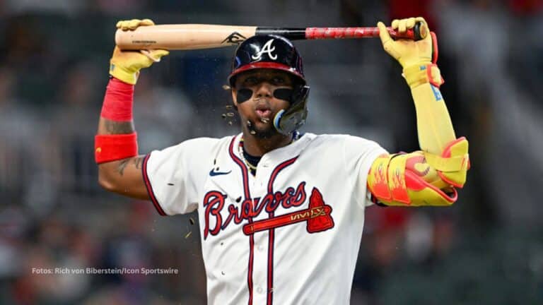 El venezolano Ronald Acuña Jr. juega con el alma y el reto es decidir cómo seguir brillando sin lesionarse en el intento.