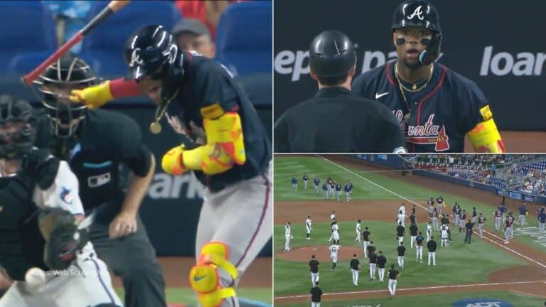 El pelotero venezolano Ronald Acuña Jr. expresó de inmediato su molestia alterado y recibió sin titubeos el apoyo de sus compañeros.