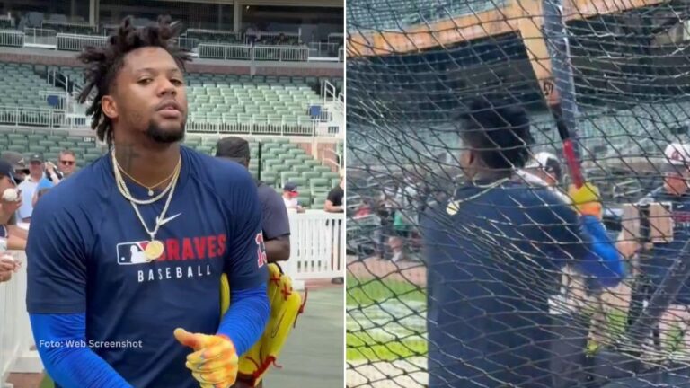 El pelotero venezolano Ronald Acuña Jr estuvo presente en las prácticas de bateo previo al encuentro ante Miami Marlins y se mostró tranquilo.
