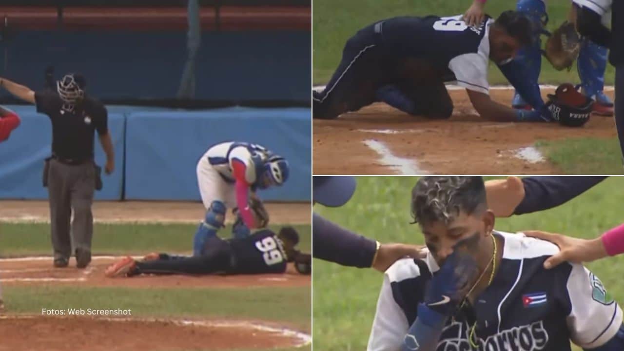 El aditamento que protegió la testa del atleta se fracturó en un segmento, como prueba de la velocidad y potencia que trajo el equivocado envío. Beisbol cubano